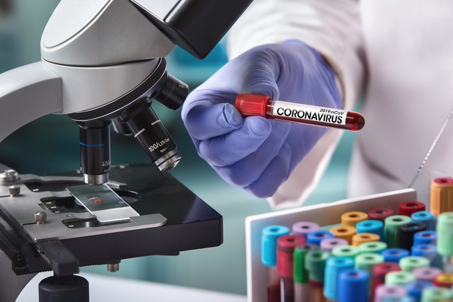 İstanbulda koronavirus həyəcanına səbəb azərbaycanlı olub- FOTO
