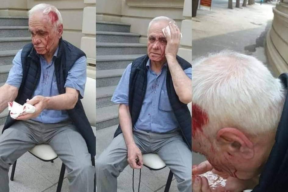 Bakıda keçmiş nazir Rəhim Qazıyevin başını yardılar – FOTOLAR