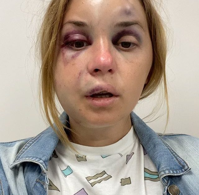 Məşhur aparıcını azyaşlı oğlunun gözü qarşısındaTƏCAVÜZƏ məruz qaldı – FOTO-VİDEO