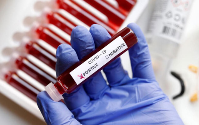 Azərbaycanda evdə müalicə olunan koronavirus xəstələrinin sayı açıqlandı