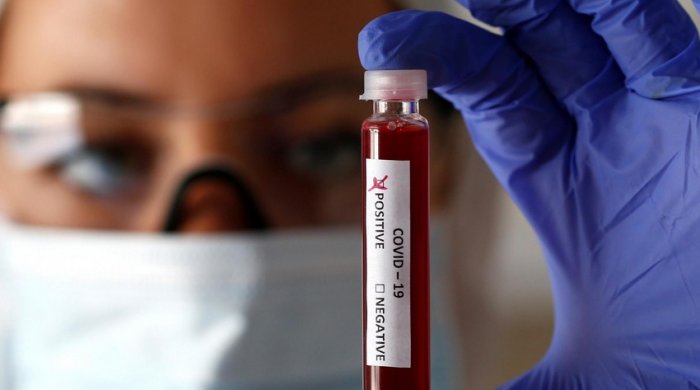 Azərbaycanda son sutkada koronavirusa yoluxanların sayı açıqlanıb