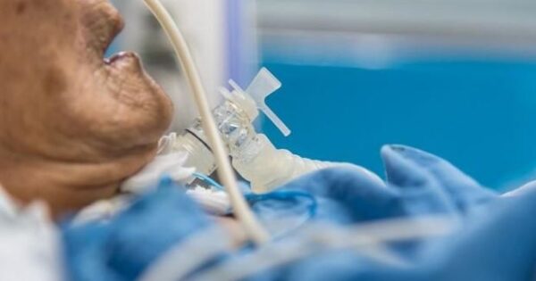 image-patient_on_ventilator_with_tracheostomy