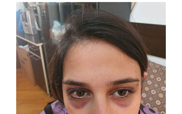 Körpəsini qoruduğu üçün döyülən qadınla bağlı - DİN-dən açıqlama 1 image-ana