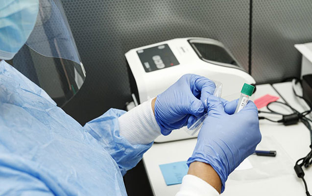 Azərbaycanda koronavirusdan 2 nəfər ölüb - FOTO 3 image-korona