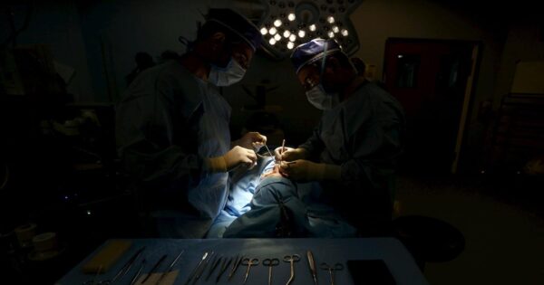 image-beyin-emeliyyati