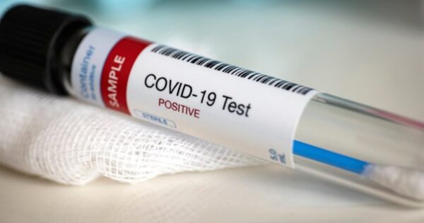 image-covid-19