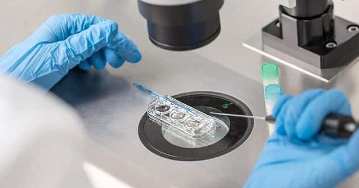 Süni mayalanmaya gedən kişilər ehtiyatlı olun – ŞOK FAKT 1 image-1707716115-suni-mayalanma-nece-aparilir