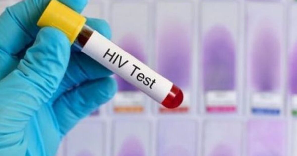 Ötən ay 108 nəfər İİV-ə yoluxub 1 image-1708324030-c5b4952f2e745d0d8799e9838a6418cd