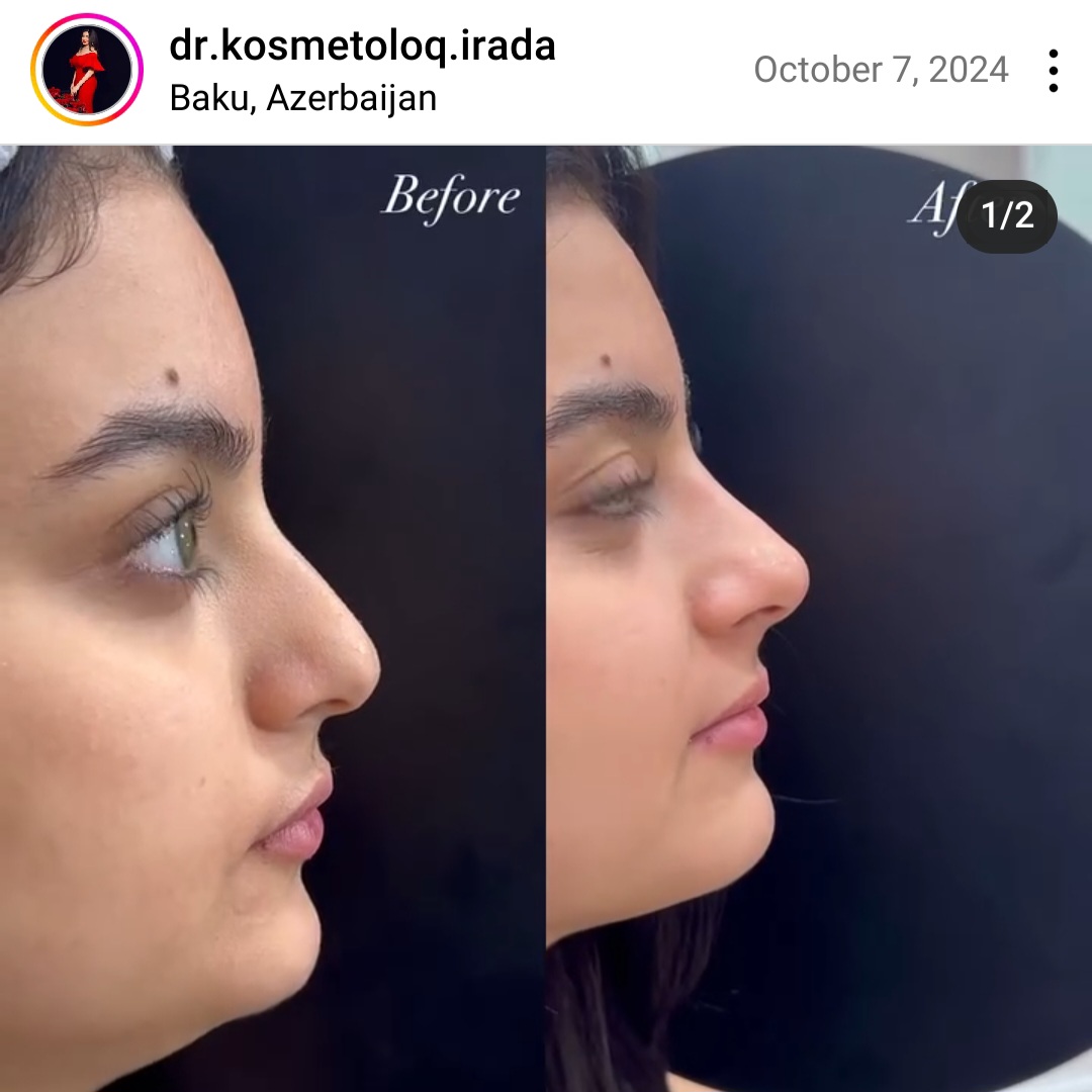 image-screenshot_20250517_131940_instagram-lite