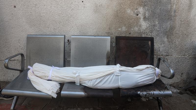 Qəzzada ölənlərin sayı 67 183 nəfərə çatdı 1 image-gazze-aa-2383599_1